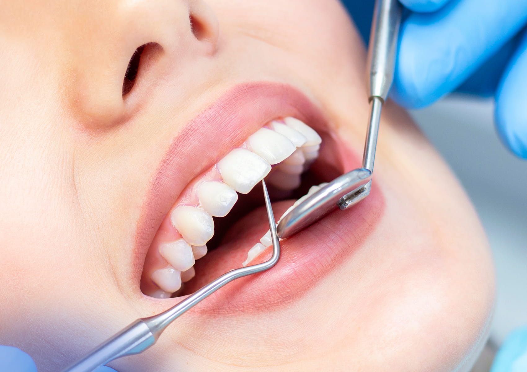dental checkup image