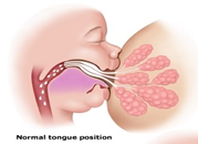 breastfeeding and tongue tie Copy 2