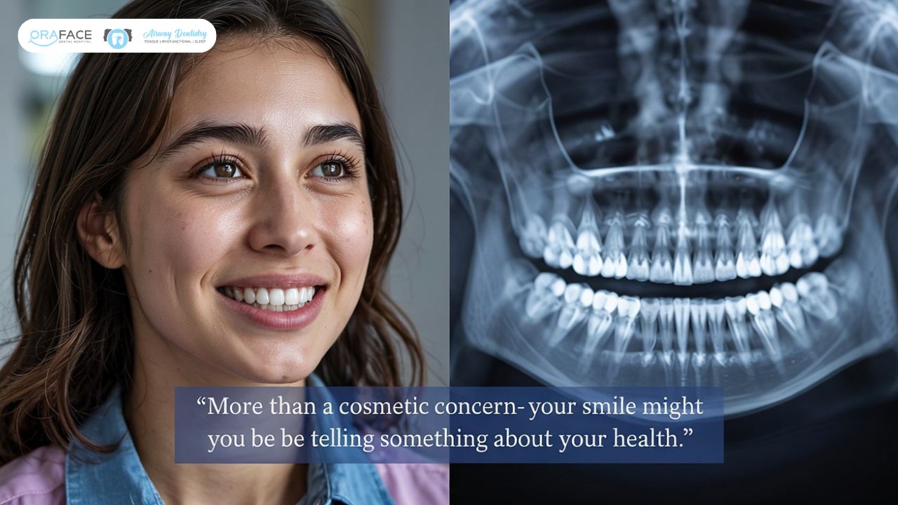 Title: Crooked Teeth: Just a Question of Appearance or a Sign of Serious Health Risk? Prompt: Many people view crooked teeth as a simple cosmetic issue—something that affects smiles and selfies. But is that really all there is to it? In this blog post, dive deeper into the real impact of dental misalignment. Explore how crooked teeth can lead to serious oral health concerns such as tooth decay, gum disease, jaw pain, speech difficulties, and even digestive issues due to improper chewing. Break the myth that it’s purely aesthetic, and educate your readers on the potential health consequences of ignoring misalignment. Include insights from dentists or orthodontists, and offer guidance on treatment options. Suggested Realistic Image: A split-image photo: One half shows a close-up of a smiling person with noticeably crooked teeth. The other half shows an X-ray or digital scan highlighting the misalignment and its effects on the jaw or surrounding teeth. Caption: “More than a cosmetic concern—your smile might be telling you something about your health.”