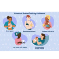 Breastfeeding